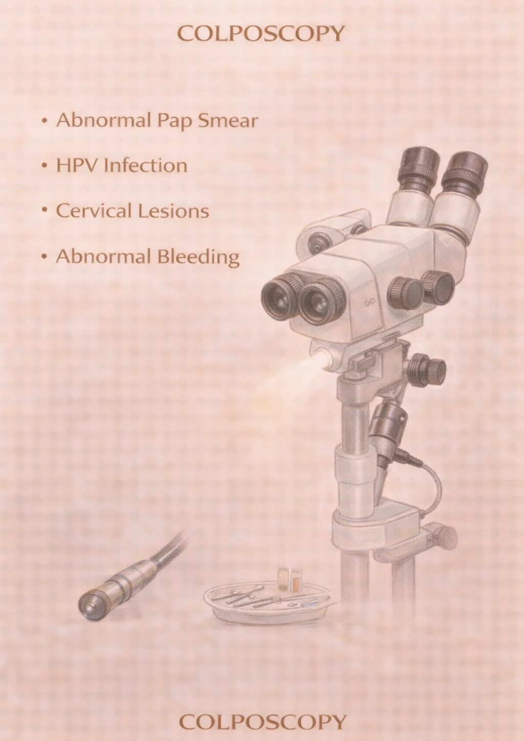 Colposcopy Procedure - Medical illustration showing colposcopy equipment for evaluating abnormal Pap smears, HPV infection, and cervical lesions